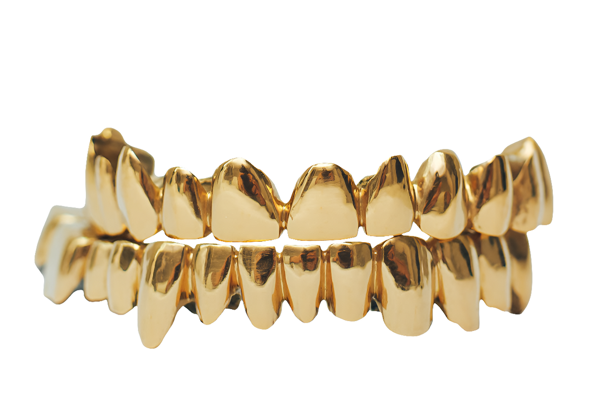 Custom 10k-14k Gold Grillz